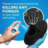 Fungal Nail Treatment with Shoe and Sock Spray with Nail Polish Nude