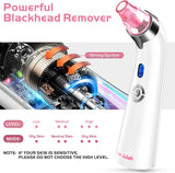 𝐁𝐥𝐚𝐜𝐤𝐡𝐞𝐚𝐝 𝐑𝐞𝐦𝐨𝐯𝐞𝐫 𝐏𝐨𝐫𝐞 𝐕𝐚𝐜𝐮𝐮𝐦 - Facial Pore Cleaner - Electric Acne Comedone Whitehead Extractor W/5 Suction Power 4 Probes, USB Rechargeable Blackhead Vacuum Removal Kit