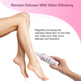 Saviland Callus Remover for Feet – 4.06Fl.Oz/120 ML Callus Remover Gel and Foot Repair Cream with Pumice Stone Foot File, Foot Callus Remover Dead Skin Remover for Feet Pedicure Foot Care Home Salon Use