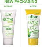 Alba Botanica Acnedote, Oil Control Lotion, 2 Ounce